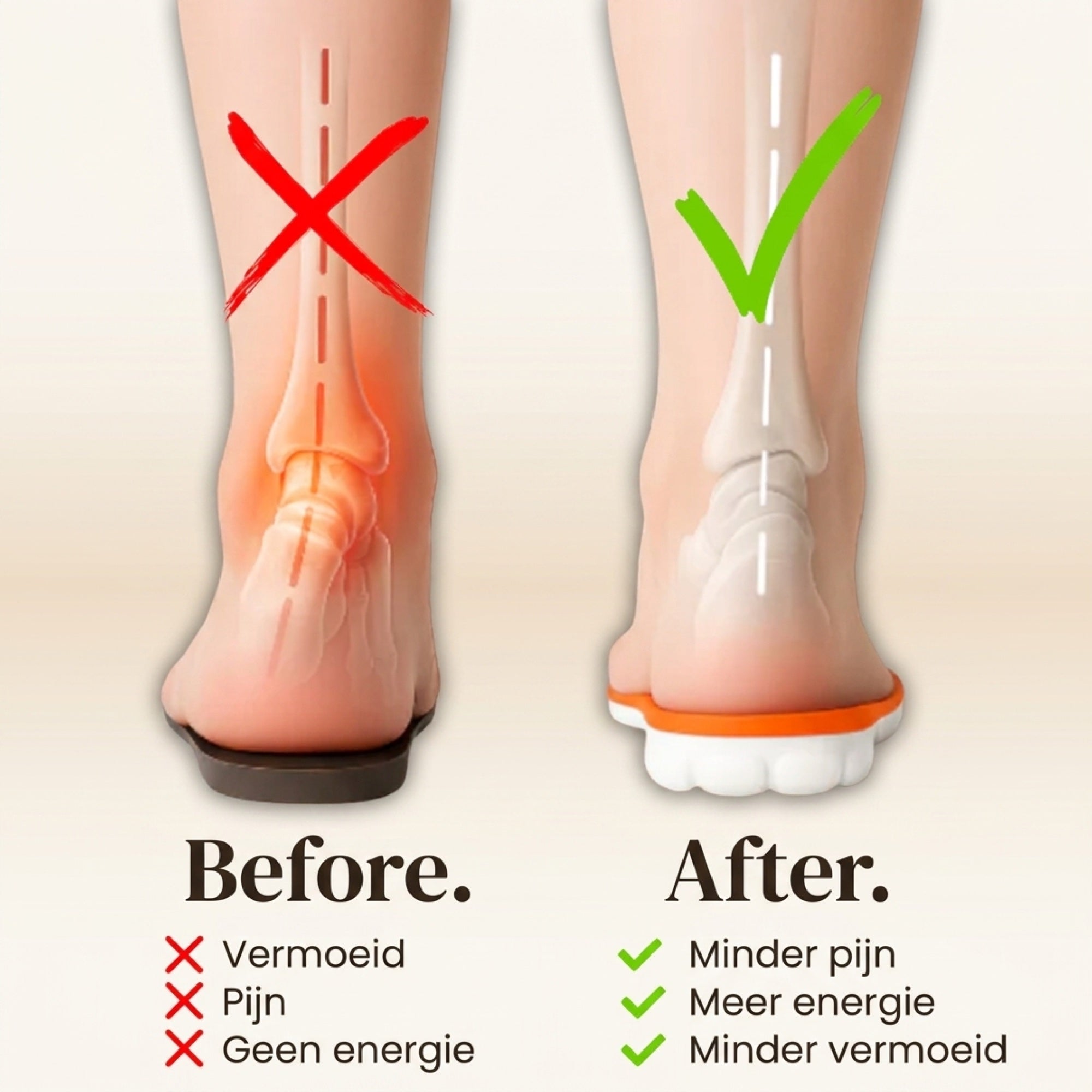 Vergelijking voor en na het dragen van de inlegzolen